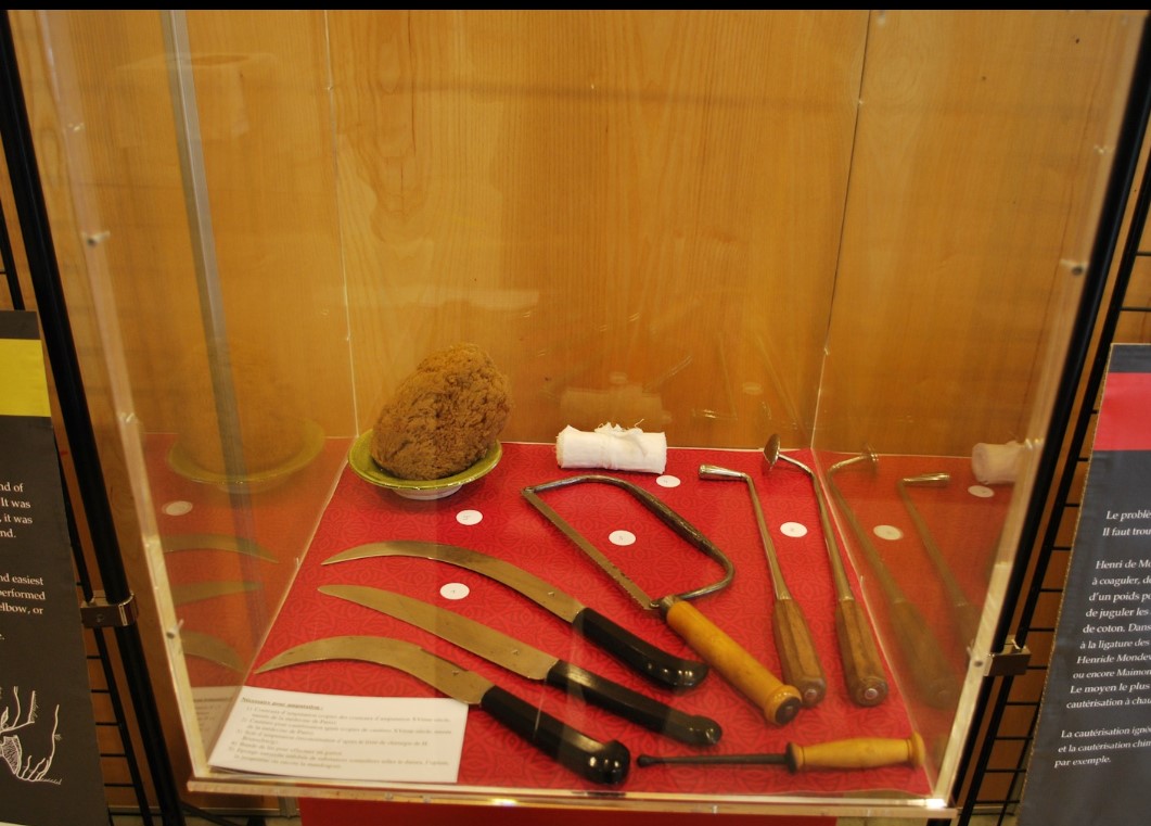 Azincourt 1415 : vitrine amputation de l'exposition sur la chirurgie de guerre