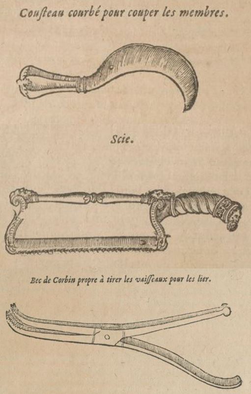 instruments de chirurgie Renaissance pour amputation par Ambroise Paré