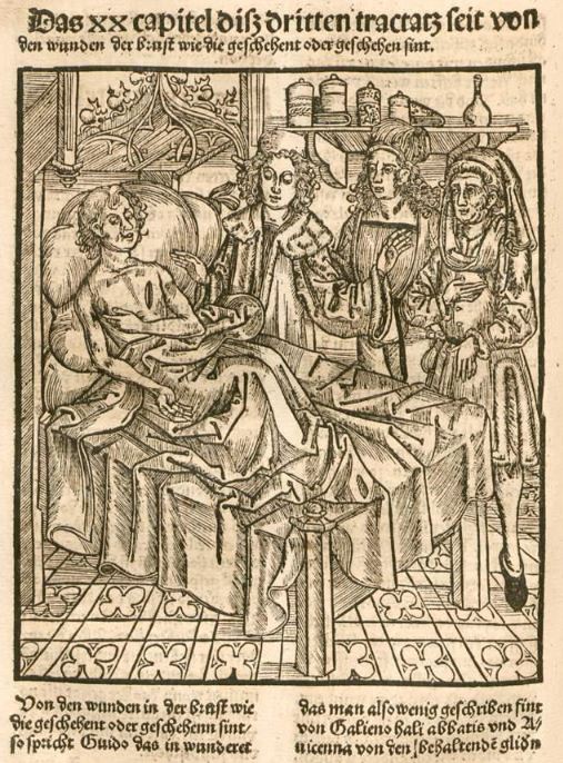 Chirurgie médiévale - examen d'une plaie au torse par Hieronymus Brunschwig