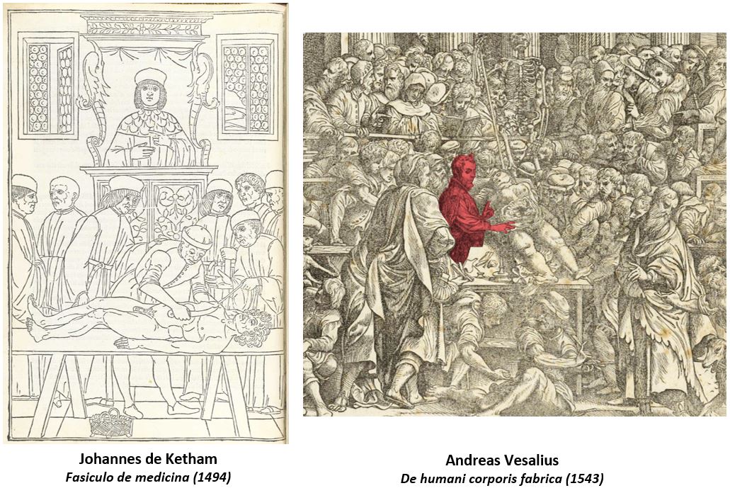 Comparaison de leçon d'anatomie médiévale et Renaissance par Vésale